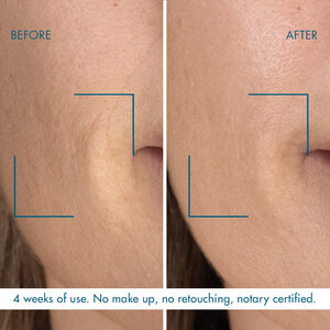 Biotherm Night Serum Before and After